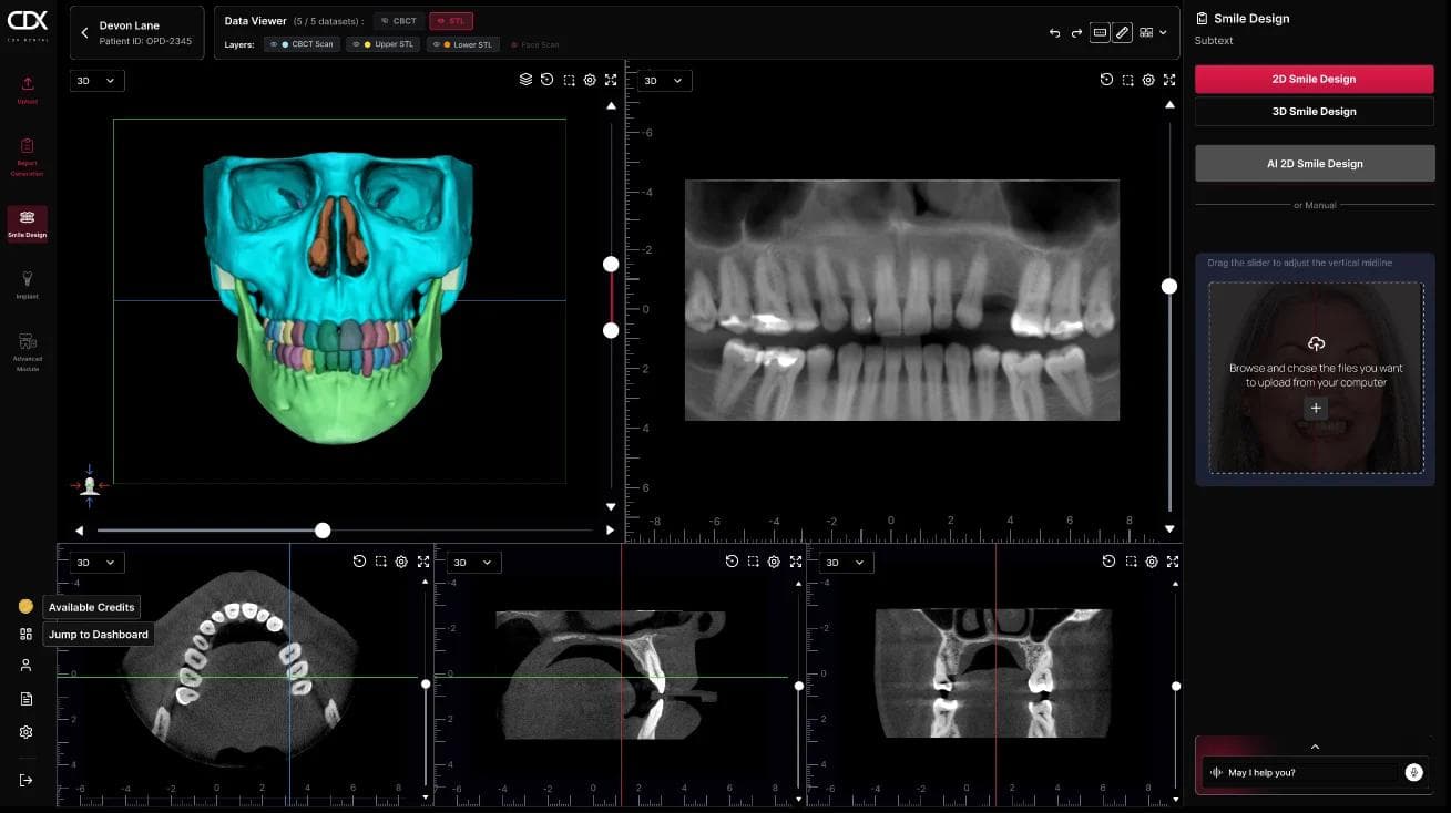 CDX Dental preview